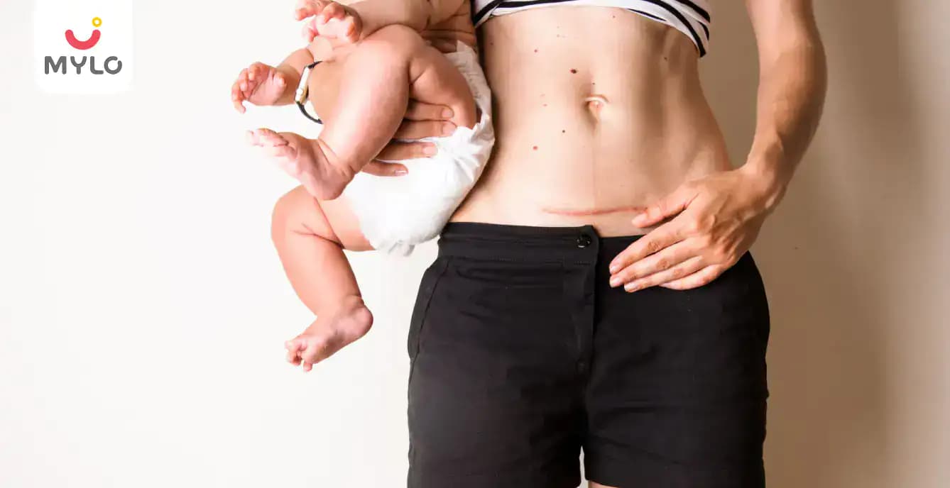 Why Does C-Section Scar Hurt Years Later in Hindi | सी-सेक्शन के निशान में सालों बाद भी दर्द क्यों होता है?