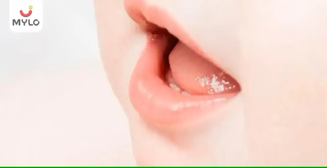 குழந்தையின் உதடு வெடிப்பிற்கு காரணங்கள் மற்றும் சிகிச்சைகள்