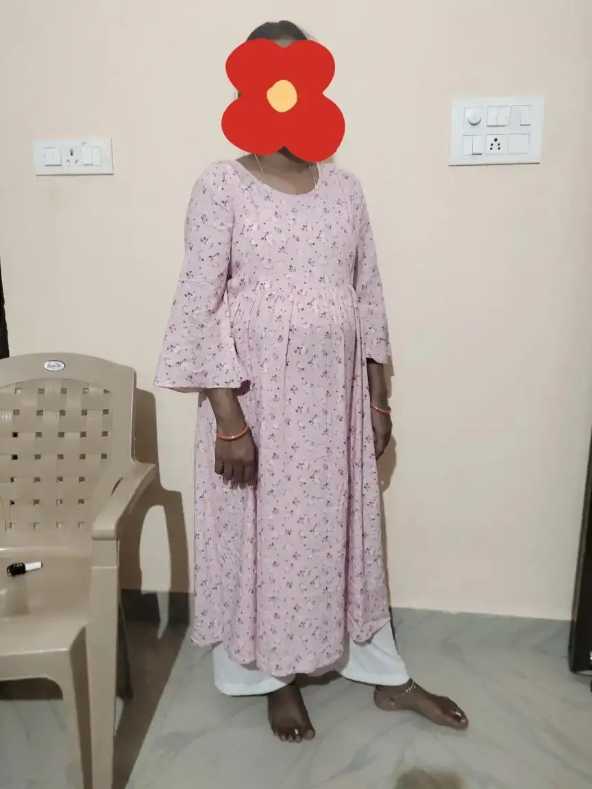 Pre & Post Maternity /Nursing Midi Dress with both sides Zipper for Easy Feeding – Floral - Grey–L