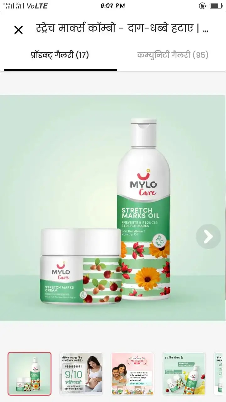 Stretch Marks Kit - Removes Scars | Made with Natural Ingredients | Tightens Skin - (1 Stretch Mark Oil - 100 ml, 2 Stretch Marks Cream - 100ml each)