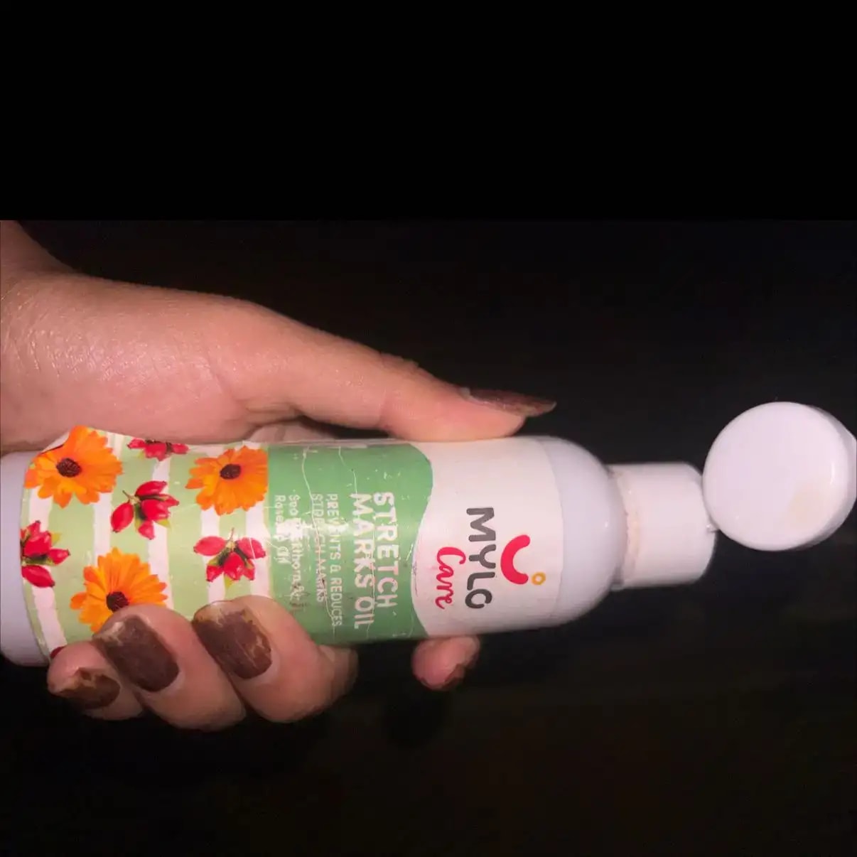 Stretch Marks Kit - Removes Scars | Made with Natural Ingredients | Tightens Skin - (1 Stretch Mark Oil - 100 ml, 2 Stretch Marks Cream - 100ml each)