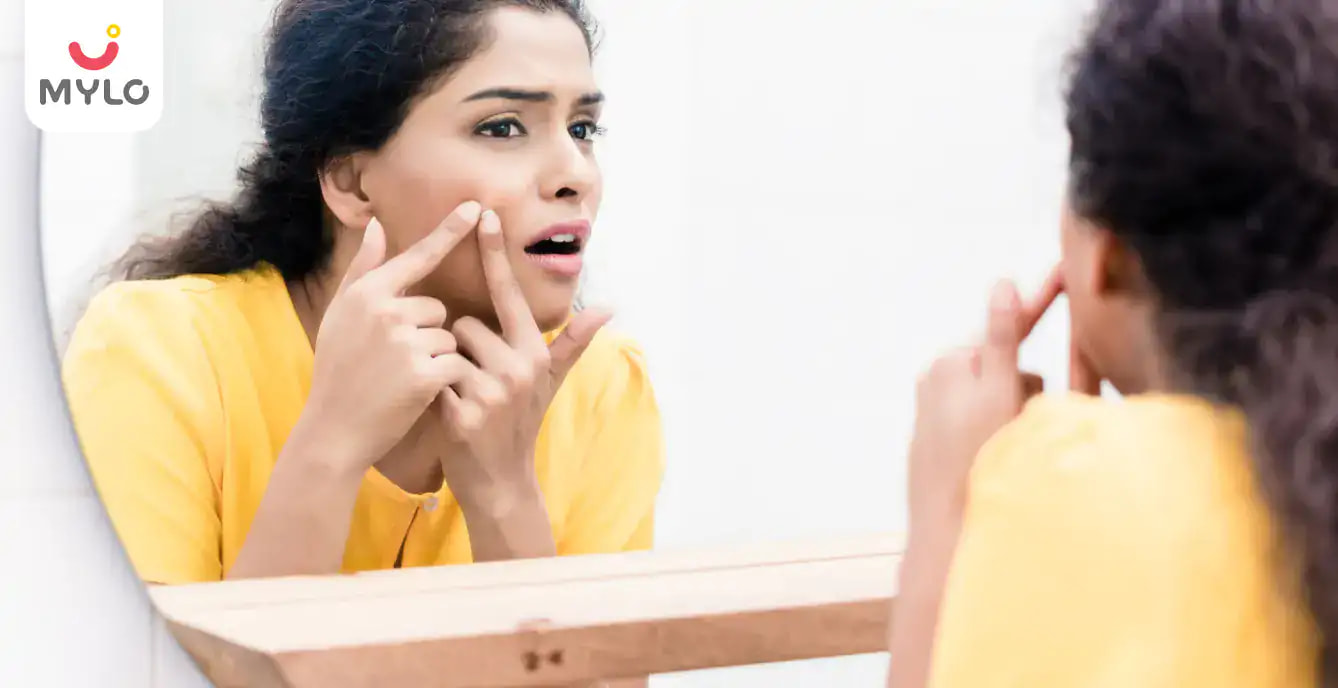  ত্বকে ব্রণের ৩ টি প্রধান কারণ  | 3 Main Causes Of Acne On The Skin in Bengali