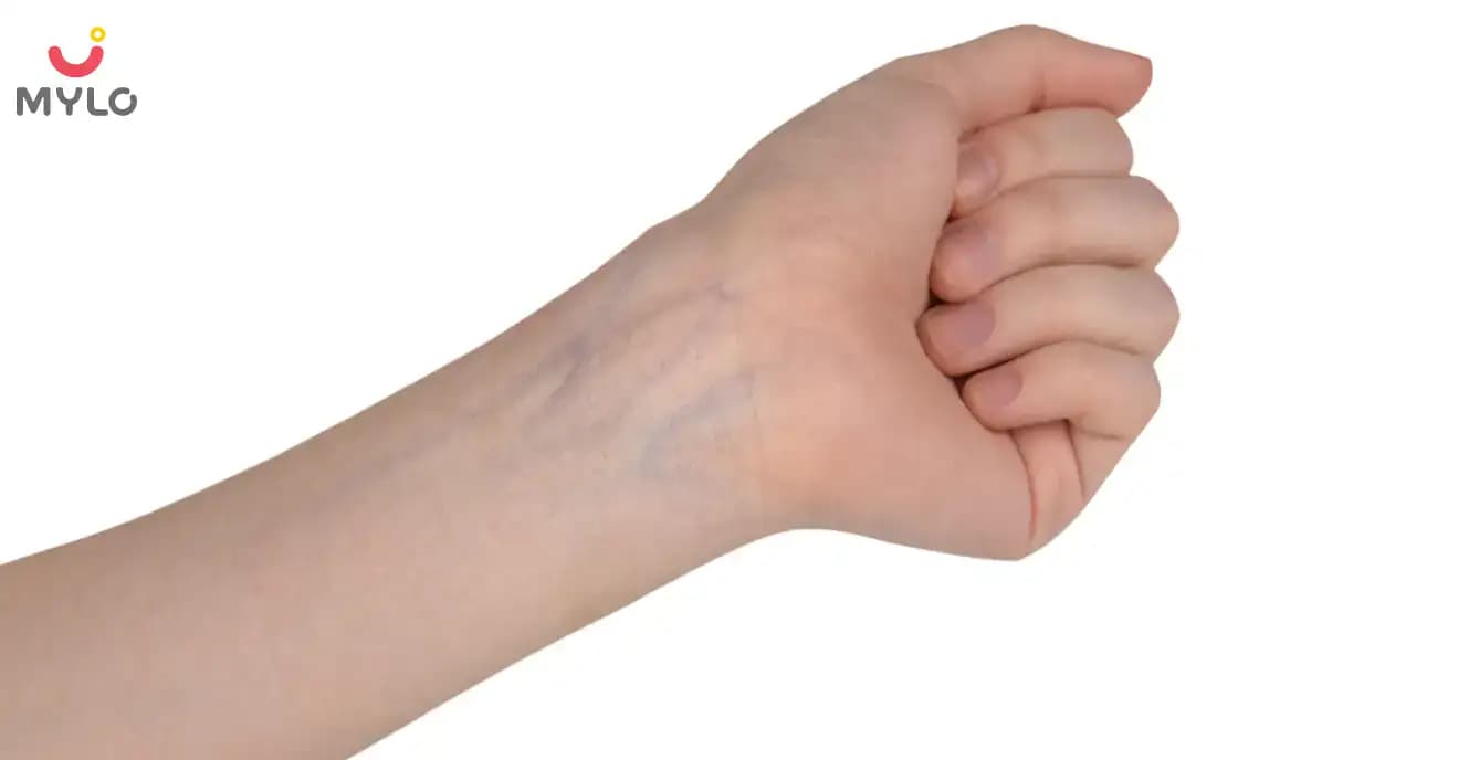Do You Have Veiny Hands? Is This Something to Be Concerned About?