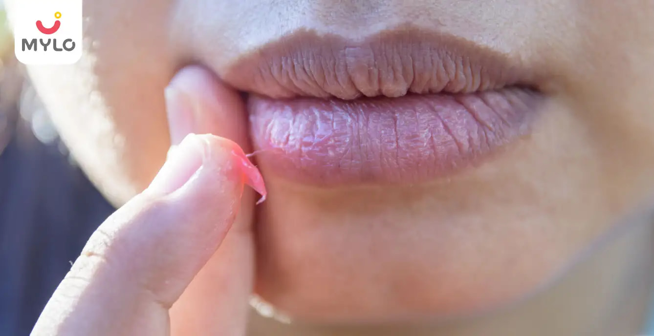 Dry Lips During Pregnancy in Hindi | प्रेग्नेंसी में क्यों सूखते हैं होठ?