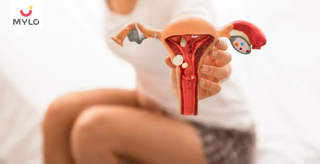 Ovarian Cyst: Types, Causes, Symptoms and Treatment