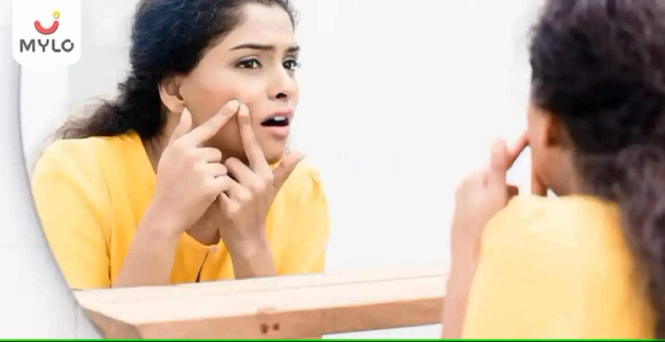  தோலில் முகப்பரு வருவதற்கான 3 முக்கிய காரணங்கள் (3 Main Causes Of Acne On The Skin In Tamil)     