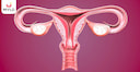 Images related to Anteverted Uterus in Hindi Meaning | क्या आप एंटेवर्टेड यूटरस होने पर प्रेग्नेंट हो सकते हैं? 