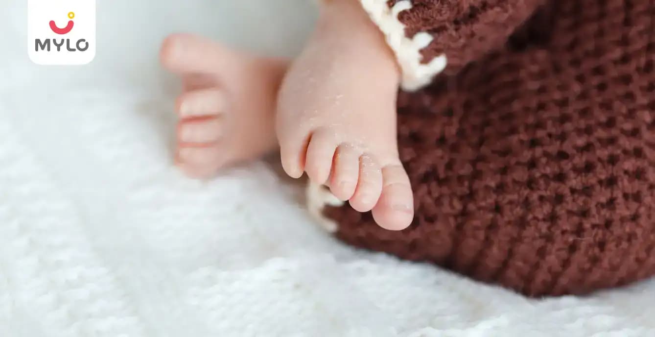 Newborn’s Skin Peeling Causes & Treatment