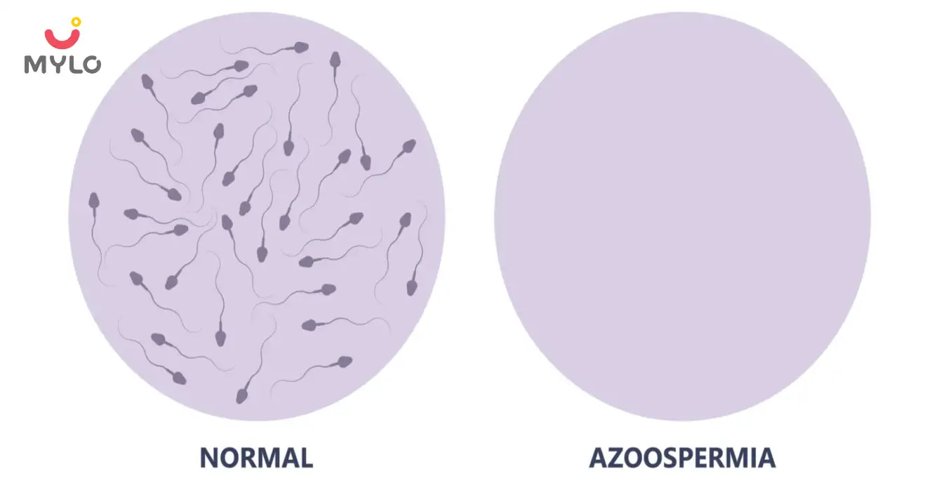 Azoospermia and Male Fertility: What Every Man Should Know