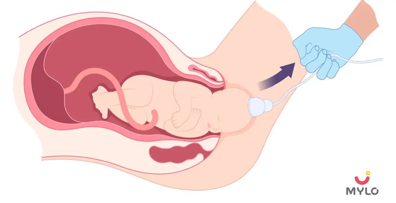 Things Pregnant Women Should Know About Vacuum Delivery